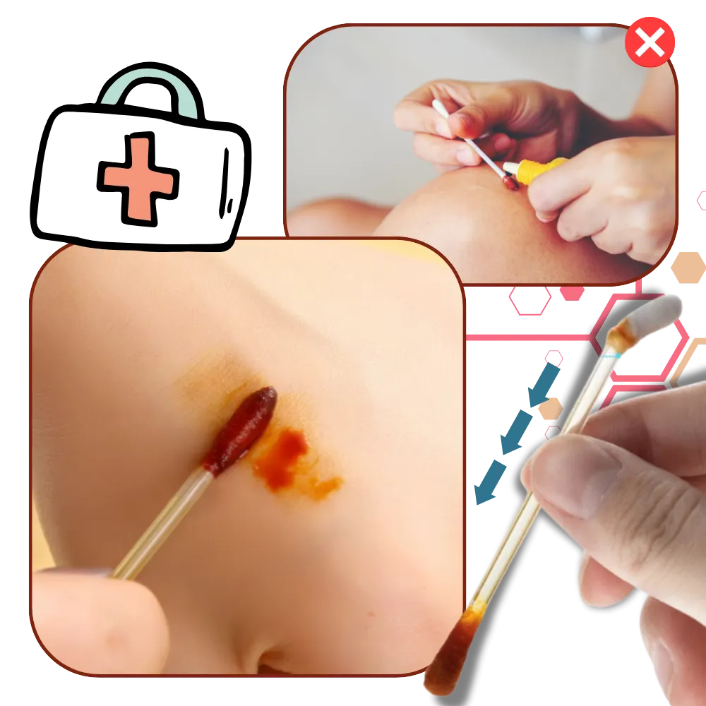 Iodine Alcohol Swabsticks
